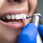 Is it Worth Getting Dental Insurance in Australia?